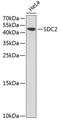 Syndecan 2 antibody, A03827, Boster Biological Technology, Western Blot image 