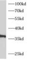 Adenosine A1 Receptor antibody, FNab00159, FineTest, Western Blot image 