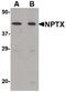 Neuronal pentraxin-2 antibody, PA5-20521, Invitrogen Antibodies, Western Blot image 