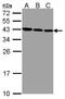 ZW10 Interacting Kinetochore Protein antibody, PA5-28538, Invitrogen Antibodies, Western Blot image 