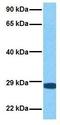 BPI Fold Containing Family A Member 1 antibody, GTX47015, GeneTex, Western Blot image 