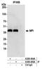 Mannose Phosphate Isomerase antibody, A305-495A, Bethyl Labs, Immunoprecipitation image 