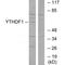 YTH N6-Methyladenosine RNA Binding Protein 1 antibody, A09853, Boster Biological Technology, Western Blot image 