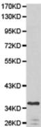 MTOR Associated Protein, LST8 Homolog antibody, TA324118, Origene, Western Blot image 