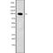 Zinc Finger Protein 227 antibody, abx219459, Abbexa, Western Blot image 