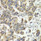 ADP/ATP translocase 1 antibody, A1882, ABclonal Technology, Immunohistochemistry paraffin image 