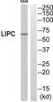 Hepatic lipase antibody, PA5-39203, Invitrogen Antibodies, Western Blot image 