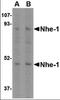 Solute Carrier Family 9 Member A1 antibody, orb88379, Biorbyt, Western Blot image 