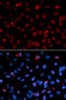 Serine And Arginine Rich Splicing Factor 1 antibody, 16-628, ProSci, Immunofluorescence image 