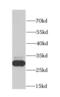 Carbonic anhydrase 3 antibody, FNab01162, FineTest, Western Blot image 