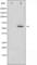 Disabled homolog 1 antibody, abx010623, Abbexa, Western Blot image 