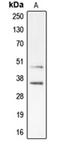 Cyclin-dependent kinase 10 antibody, orb214804, Biorbyt, Western Blot image 