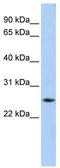 Ferritin Heavy Chain 1 antibody, TA335033, Origene, Western Blot image 