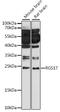 Regulator Of G Protein Signaling 17 antibody, 16-250, ProSci, Western Blot image 