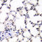 Ubiquitin-conjugating enzyme E2 B antibody, LS-C334634, Lifespan Biosciences, Immunohistochemistry frozen image 