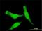 Madh7 antibody, H00004092-M01, Novus Biologicals, Immunofluorescence image 