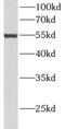 Aldehyde Dehydrogenase 3 Family Member A2 antibody, FNab00293, FineTest, Western Blot image 