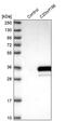 Shieldin Complex Subunit 1 antibody, PA5-59280, Invitrogen Antibodies, Western Blot image 