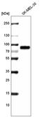 5,6-dihydroxyindole-2-carboxylic acid oxidase antibody, AMAb91328, Atlas Antibodies, Western Blot image 