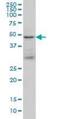 Tumor Susceptibility 101 antibody, orb94776, Biorbyt, Western Blot image 