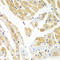 Poly(RC) Binding Protein 2 antibody, 18-693, ProSci, Immunohistochemistry paraffin image 