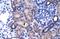 Zinc Finger Protein 84 antibody, A15280, Boster Biological Technology, Immunohistochemistry paraffin image 