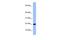 Olfactory Marker Protein antibody, GTX45044, GeneTex, Western Blot image 