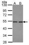 Polyribonucleotide 5 -hydroxyl-kinase Clp1 antibody, LS-C186405, Lifespan Biosciences, Western Blot image 