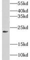 Glucosamine-Phosphate N-Acetyltransferase 1 antibody, FNab03554, FineTest, Western Blot image 