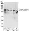 Phosphatidylinositol-3,4,5-trisphosphate 5-phosphatase 2 antibody, A300-574A, Bethyl Labs, Western Blot image 