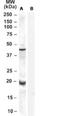 Glutathione peroxidase 7 antibody, NB100-41103, Novus Biologicals, Western Blot image 
