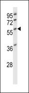 Desmin antibody, LS-C167371, Lifespan Biosciences, Western Blot image 