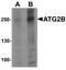 Autophagy Related 2B antibody, TA319951, Origene, Western Blot image 