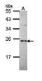 Calcineurin Like EF-Hand Protein 1 antibody, orb69922, Biorbyt, Western Blot image 