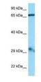 G Elongation Factor Mitochondrial 1 antibody, NBP1-98457, Novus Biologicals, Western Blot image 