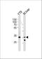 Y-Box Binding Protein 3 antibody, A07100, Boster Biological Technology, Western Blot image 