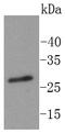 Replication Protein A2 antibody, A02067T21, Boster Biological Technology, Western Blot image 