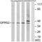 G Protein-Coupled Receptor 52 antibody, TA314888, Origene, Western Blot image 