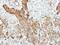 Pancreatic Lipase antibody, NBP1-32789, Novus Biologicals, Immunohistochemistry paraffin image 