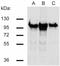 Catenin Beta 1 antibody, GTX80159, GeneTex, Western Blot image 