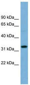 Olfactory Receptor Family 6 Subfamily C Member 68 antibody, TA336169, Origene, Western Blot image 