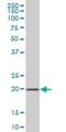 ADP Ribosylation Factor Like GTPase 6 Interacting Protein 1 antibody, H00023204-B02P, Novus Biologicals, Western Blot image 