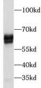 Prosaposin antibody, FNab06842, FineTest, Western Blot image 