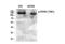 Eukaryotic Translation Initiation Factor 2 Alpha Kinase 3 antibody, P01992, Boster Biological Technology, Western Blot image 