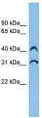 Chromosome 3 Open Reading Frame 33 antibody, TA346511, Origene, Western Blot image 