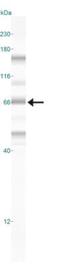 Nuclear Receptor Subfamily 5 Group A Member 2 antibody, NBP2-27204, Novus Biologicals, Western Blot image 