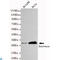 Syndecan Binding Protein antibody, LS-C813126, Lifespan Biosciences, Western Blot image 