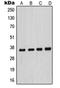 CDK-activating kinase assembly factor MAT1 antibody, orb214268, Biorbyt, Western Blot image 