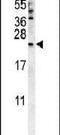 Coenzyme Q7, Hydroxylase antibody, PA5-25774, Invitrogen Antibodies, Western Blot image 