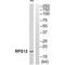 Ribosomal Protein S13 antibody, A06221, Boster Biological Technology, Western Blot image 